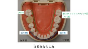 ラバーダム防湿,セミナー,ラバーダム防湿セミナー