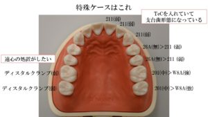 ラバーダム防湿,セミナー,ラバーダム防湿セミナー