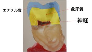 エナメル質,象牙質,神経,むし歯