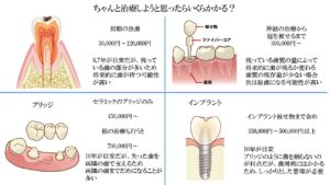 むし歯,インプラント,ブリッジ,セラミック